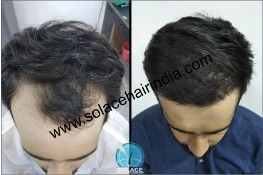 Before After