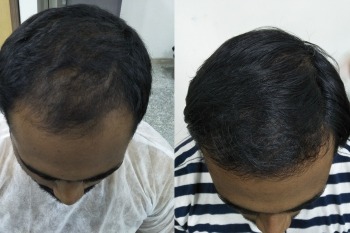 Before After
