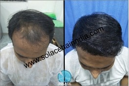 Before After