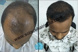 Before After