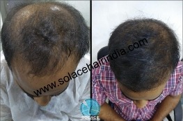 Before After