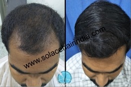 Before After