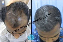 Before After